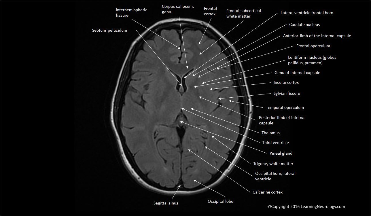 MRI image interpretation